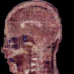 MLP sagittal