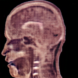 UNet sagittal