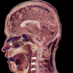 GT sagittal
