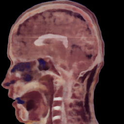 Slice MLP sagittal