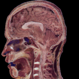 Ours sagittal