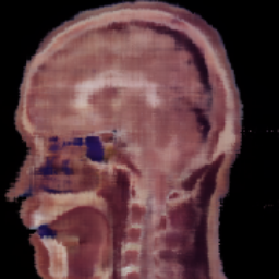 Transformer sagittal