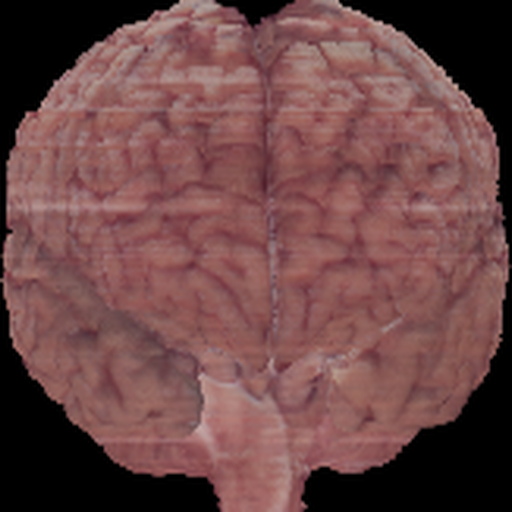 Brain GT