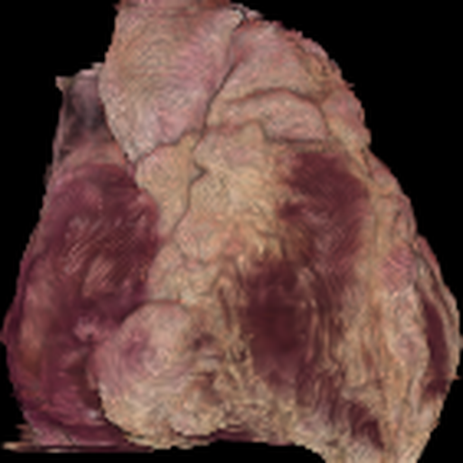 Heart Pred