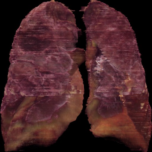 Lung GT