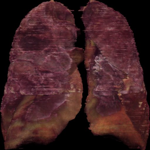 Lung Pred